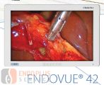 NDS Endovue 42" HD medikai képalkotó monitor