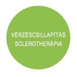 - Vérzéscsillapítás - Sclerotherápia